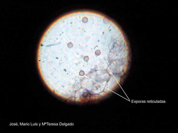 Stemonitis fusca  esporas y capilicio